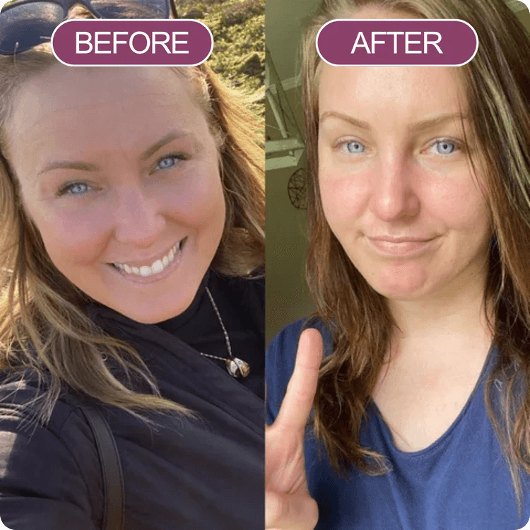 Fotografias de antes e depois de participante de estudo de percepção Dr.Medcell